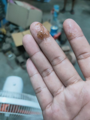 สอบถามแม่ๆหน่อยคะ