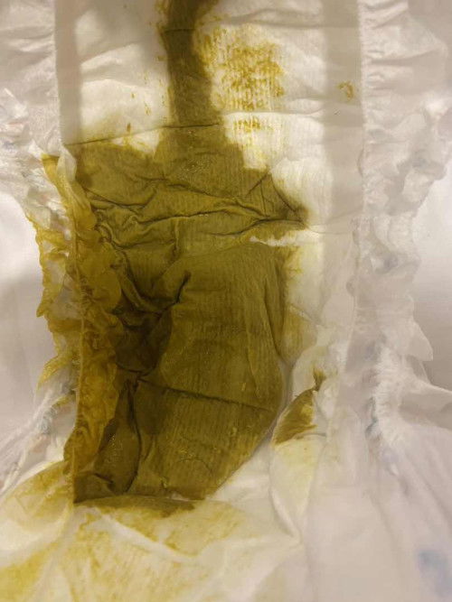 สอบถามเรื่องทารก