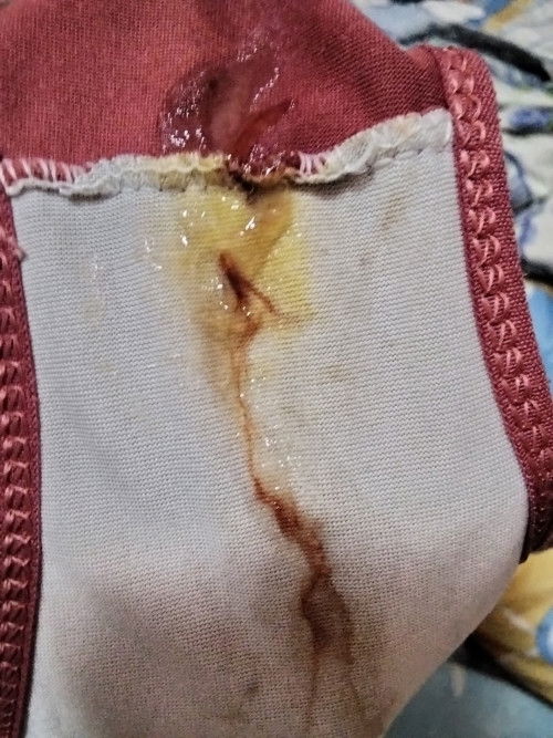 ท้องได้39+2