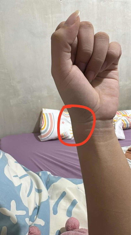 Masakit na kamay, may naka experienced po ba?