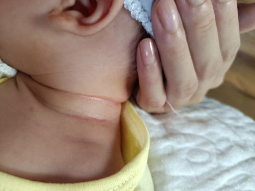 Nhìn mà xót con bác nào có cách gì chữa k ạ