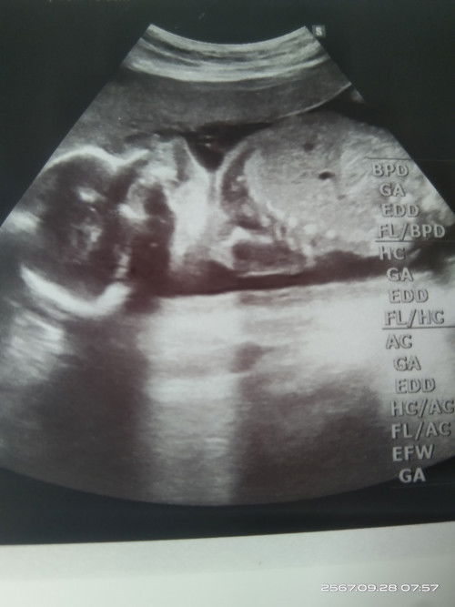 แม่ๆคนนัยพอดูออกบ้างคะว่า ผช หรือ ผญ แม่บ้านนี้ดูไม่เป็นเลย😁😁