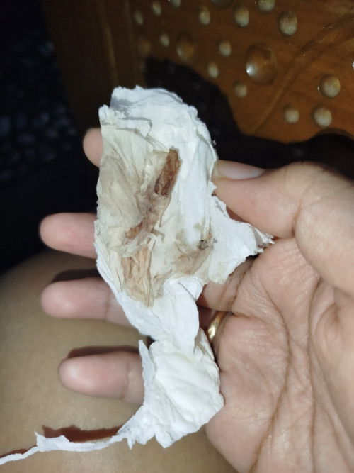 Flek implantasi atau haid