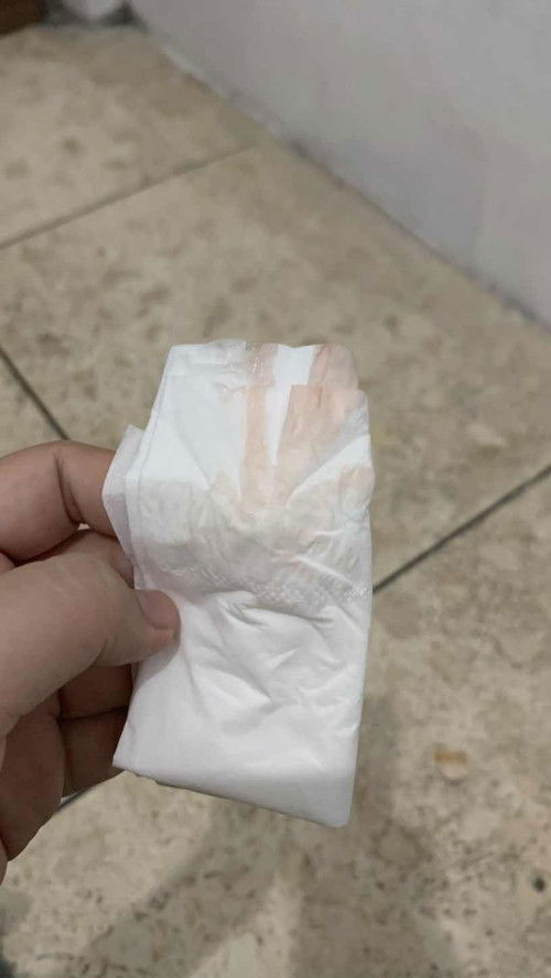 Keluar darah sedikit kadang berwarna pink