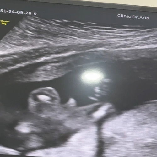 แบบนี้ชัดเจนแล้วใช่ไหมคะแม่ๆ🥹