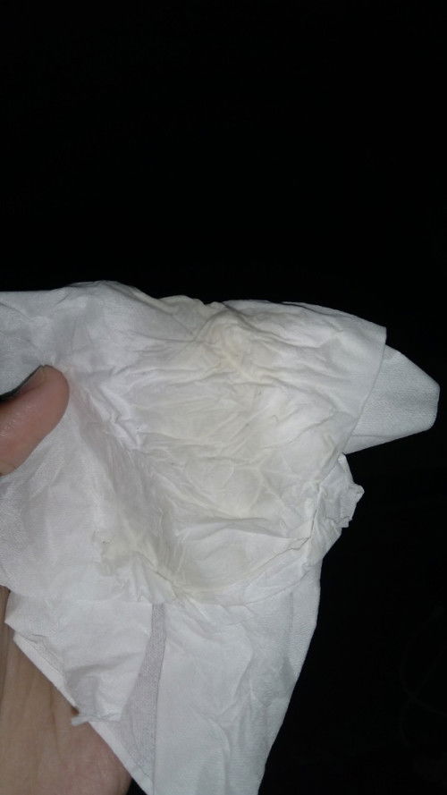 Ini cairan hormon kehamilan atau ketuban merembes ya?