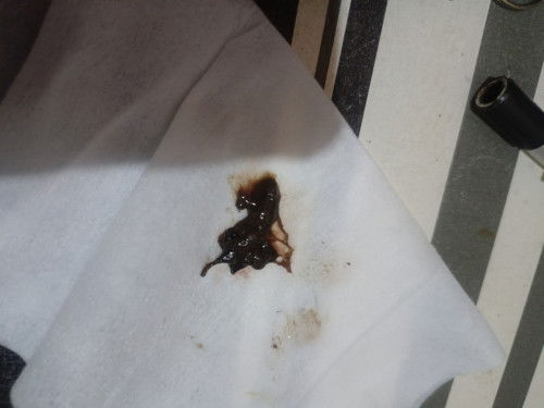 Normal lang ba ito na nilabasan ako ngayong 37weeks pregnant