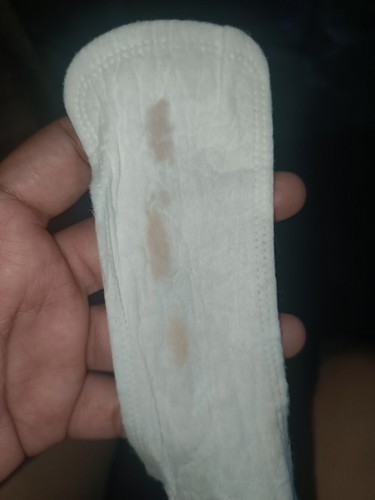 Discharge should I be worried ?