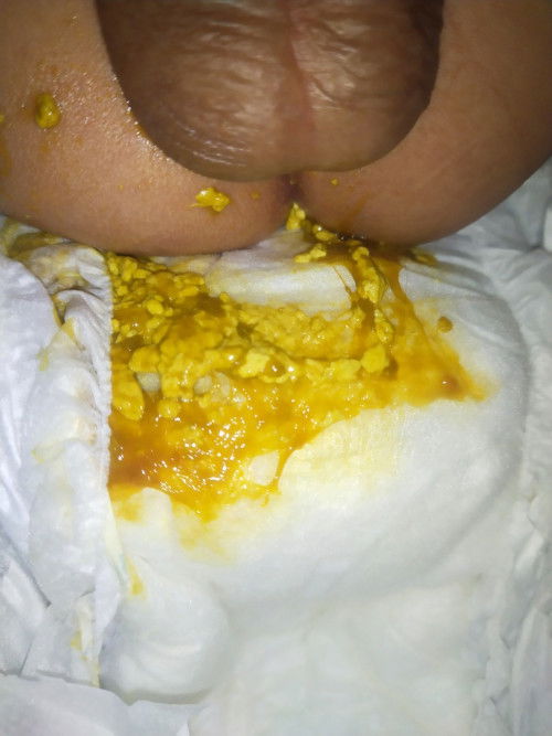 Maaf agak jorok Bun mohon infonya yg sama kaya anak saya