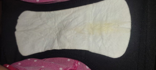 40 weeks Discharge