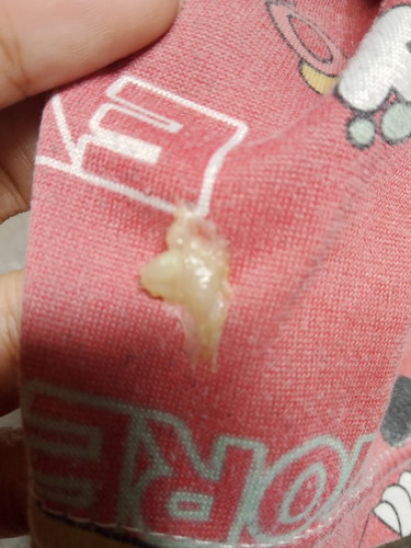 Mucus plug na kaya to?