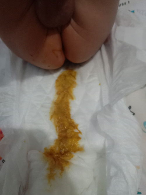 Pup bayi berair dan kecoklatan