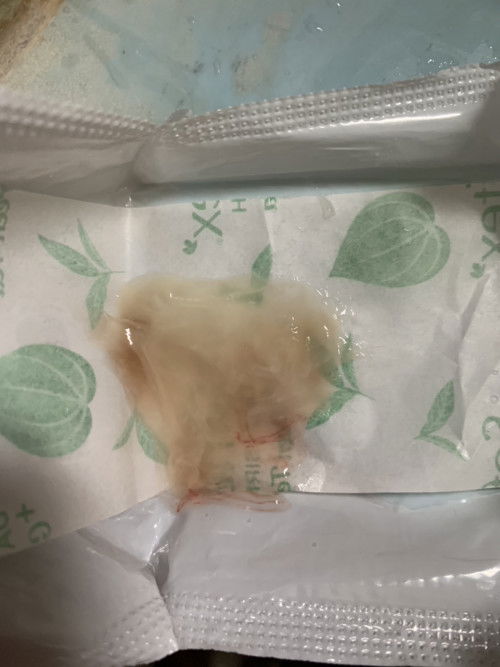 Keluar lendir bercampur darah