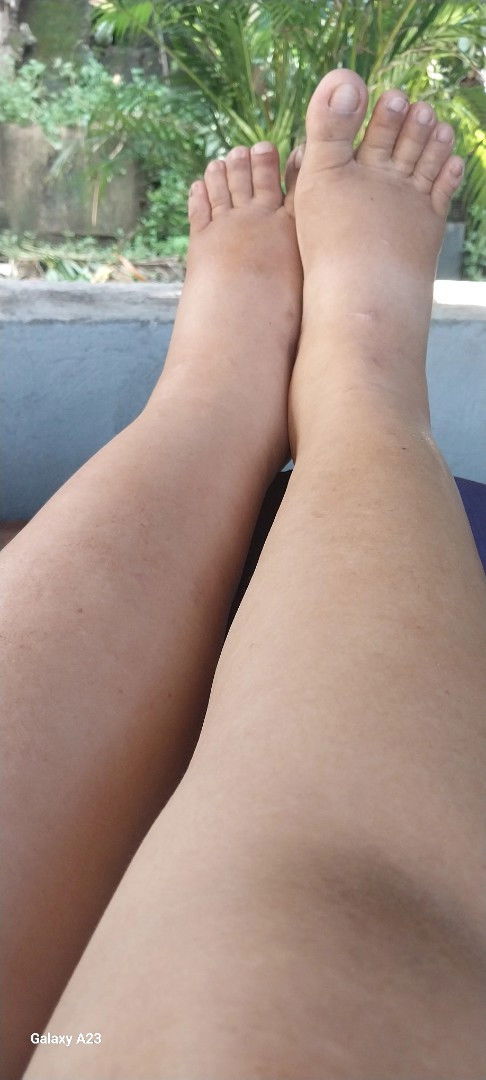 Cesarean delivery, what causes  I am 1st time mom at age 39 Y/0.