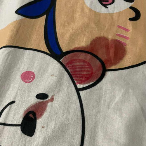 เมื่อคืนเราเลือดเลือดสีแดงสดแบบนี้ไหลออกมา36+3😞