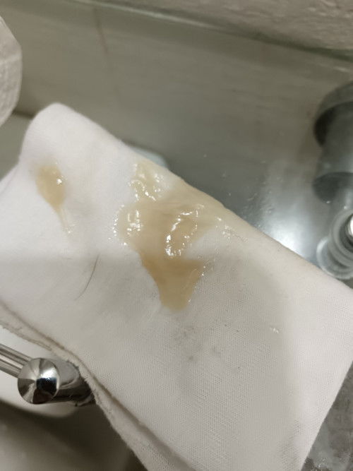 Discharge. Turning 37 weeks.