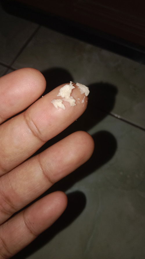 Keputihan seperti ampas tahu