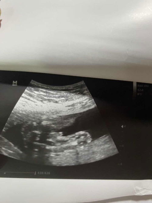 หมอบอกว่าผู้ชายแม่ๆว่าผู้ชายไหมค่ะ