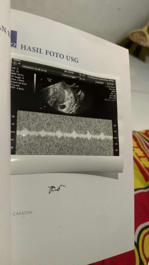 Hamil kembali setelah (KET) dan potong tuba 🥹🤲🏻