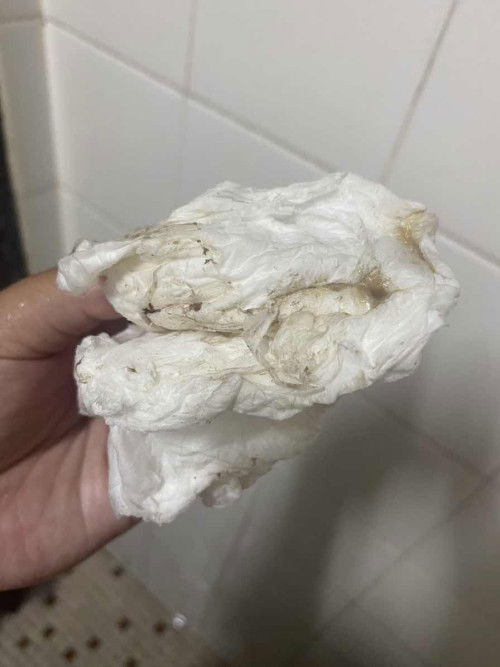 เจ็บเตือนเป็นยังไง