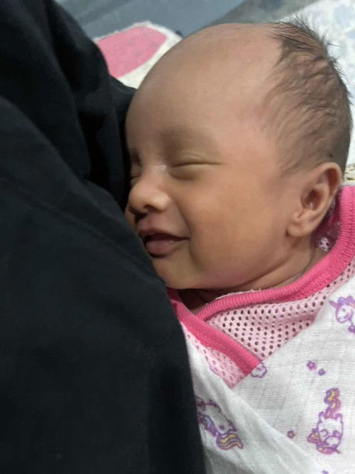 Rambut anak gugur dibhgian depan