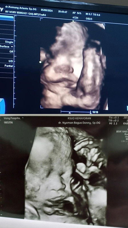 kira² dapet jadwal sc diminggu keberapa ya?