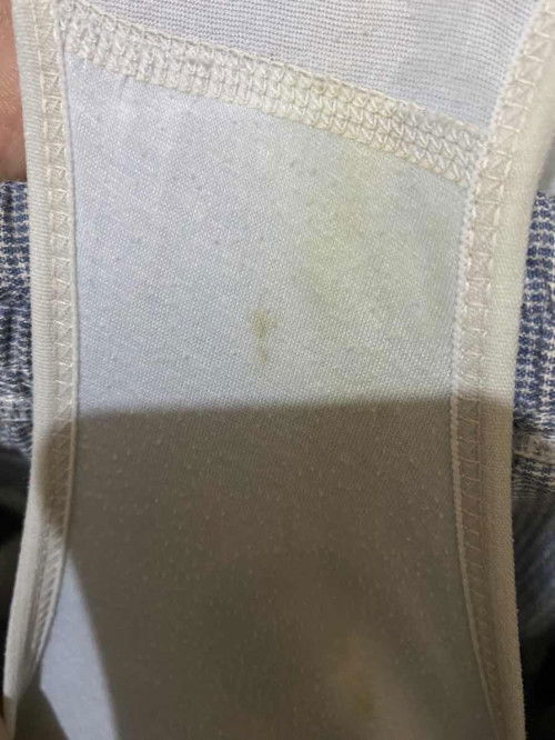 Keputihan atau ngflek?