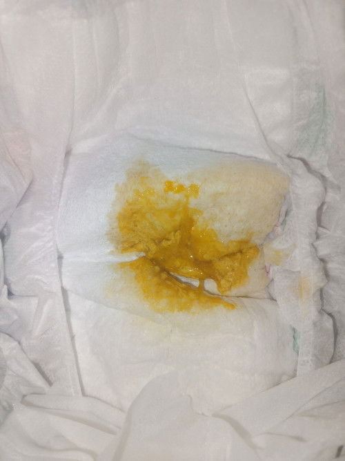 Pasintabi po sa picture !!! Mix feeding