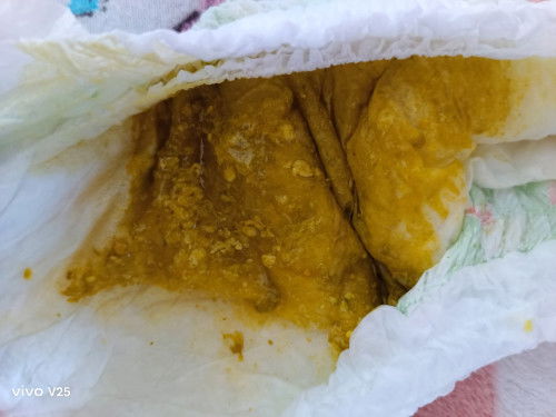 ถ่ายแบบนี้ผิดปกติไหมคะ