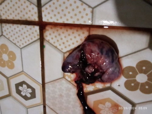 Kira² ini apa yah Bun 
Jaringan atau apa saya tidak tau soalnya hamil pertama kali