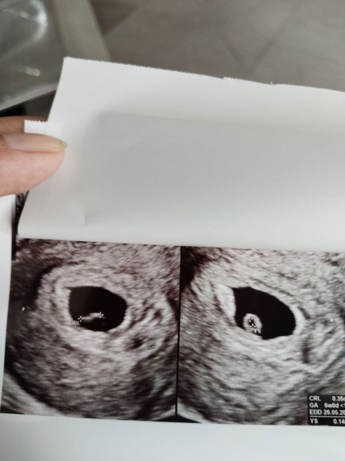 DJJ blm terdeteksi, ada yg sama?