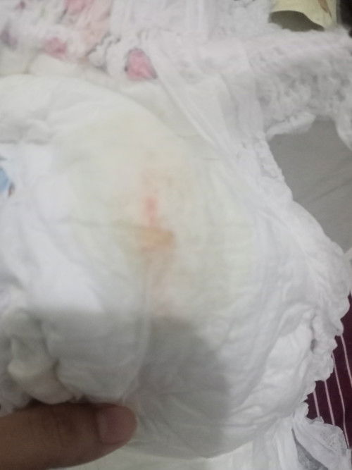 bun ada yg pernah kyk gini ga ya pipis anknya?