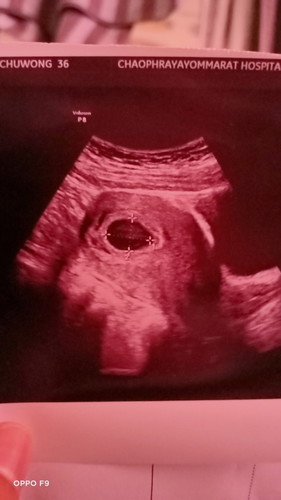 ตั้งครรภ์9week