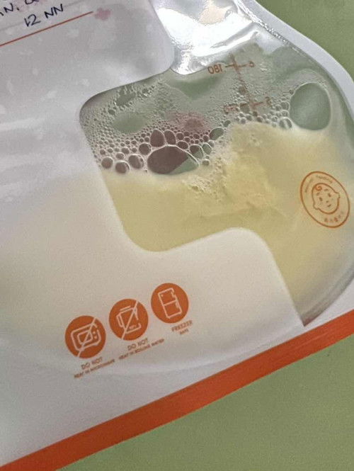 Clumps sa freshly pumped breastmilk