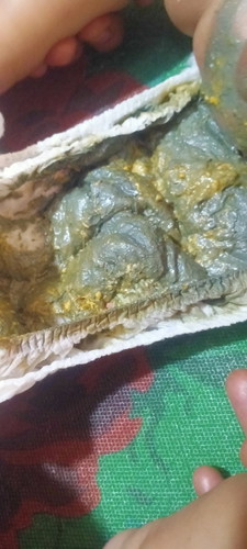 Bun anakku umur 3bulanminum sufor Morinagbmt warna pupnya kadang ijo kadang item kayak lumpur gitu?