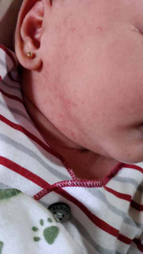 Merah" gitu Bun kasih apa Bun supaya ga merah" lagi ?