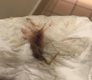 Brown Discharge 38weeks pregnant