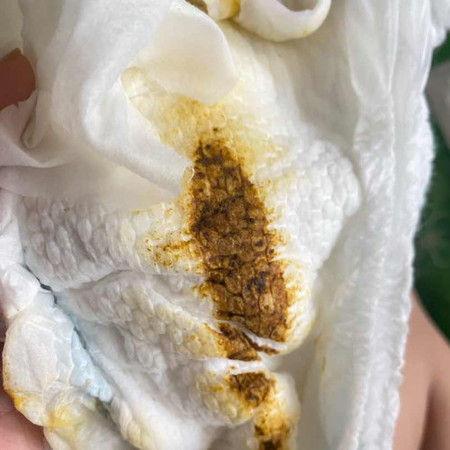 Pup bayi yang normal setelah mpasi
