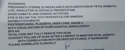 Normal lang po ba na sa 35weeks hindi pa din fully seen yung face ni baby?
