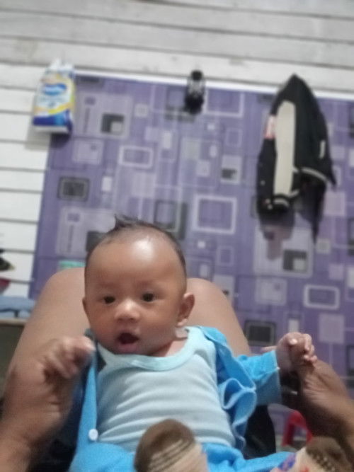 Rambut bayi 3 bulan rontok