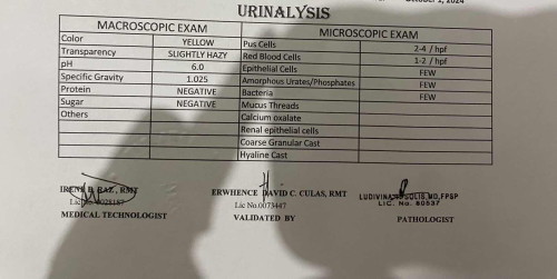 CBC & URINALYSIS