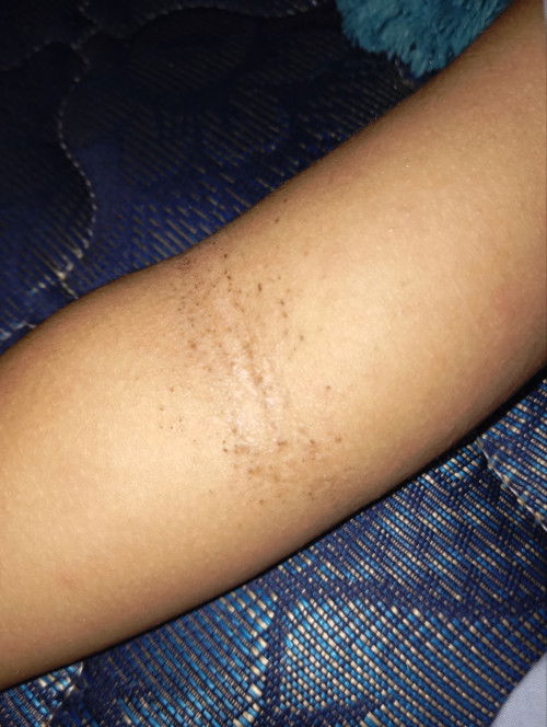 Ada yang tau ga ini kenapa? Atau anakny pernah ngalamin