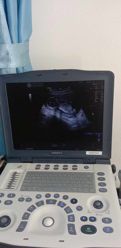 อยากได้ลูกสาวมาก