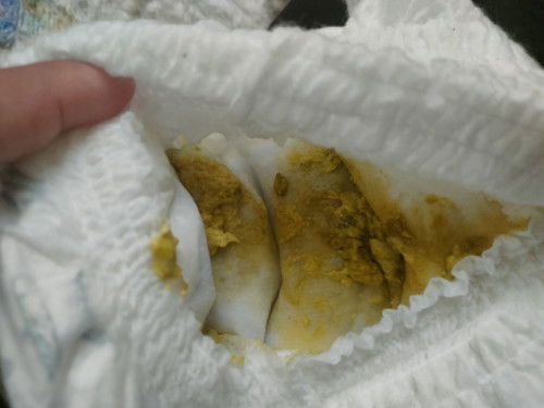 Normal ke bby tengah cirit