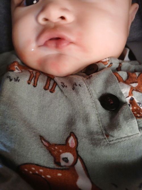 Pipi merah setelah makan