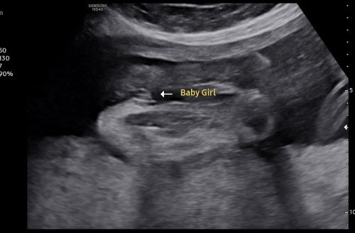 Confirmation gender