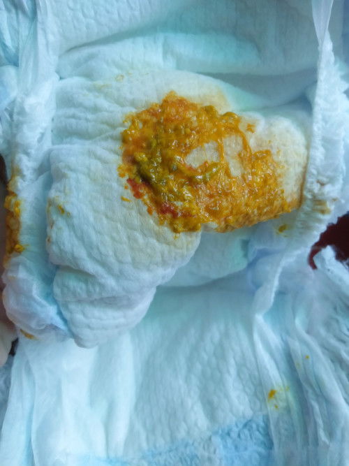 น้องถ่ายมีเลือดปนแบบนี้เป็นอะไรไหมค่ะ น้องร่าเริง กินนมได้ ไม่มีไข้ นอนปกติค่ะ