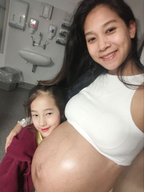 ท้องแฝด 32+5วีค