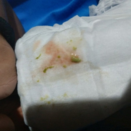 ada yang samakah Bun anak saya bab nya berwarna hijau dan bercampur lendir seperti di foto normalkah