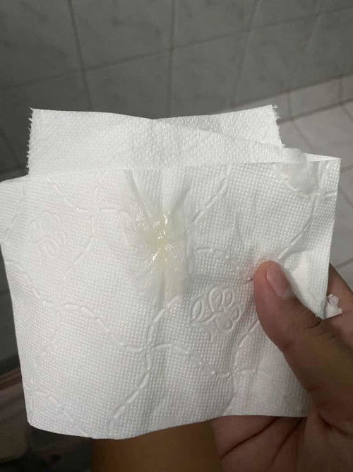 มีมูกใสเเบบนี้ใกล้จะคลอดหรือยัง